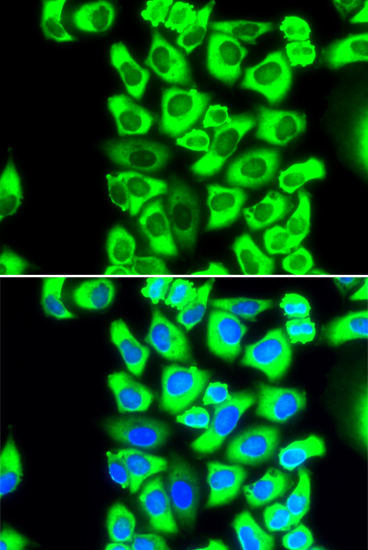 RPS3A Rabbit polyclonal antibody