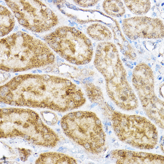 RPL4 Rabbit polyclonal antibody