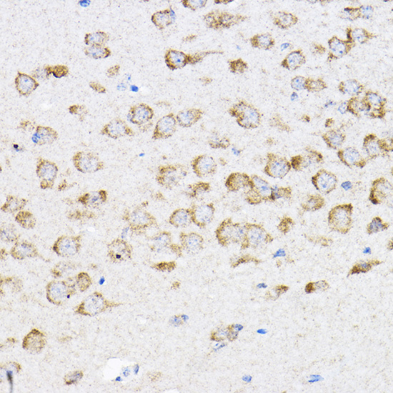 RPL4 Rabbit polyclonal antibody