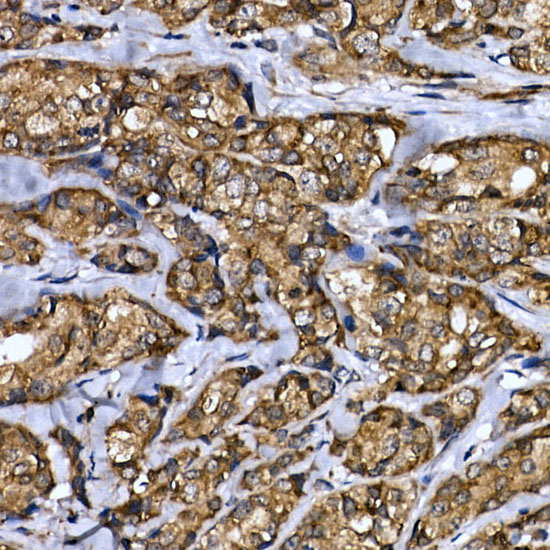 MTDH Rabbit polyclonal antibody