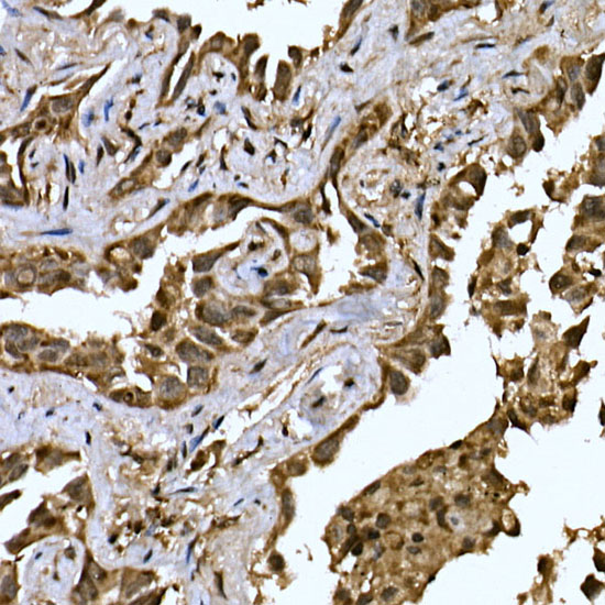MTDH Rabbit polyclonal antibody