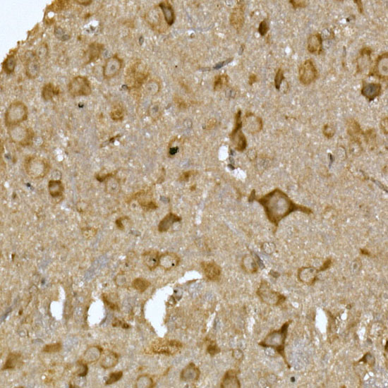MTDH Rabbit polyclonal antibody