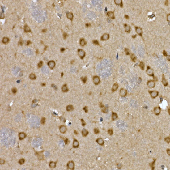 MTDH Rabbit polyclonal antibody