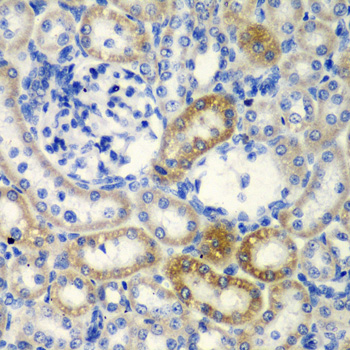DCTD Rabbit polyclonal antibody