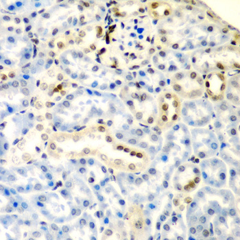 DCTD Rabbit polyclonal antibody