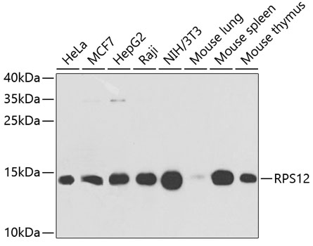 RPS12 Rabbit polyclonal antibody