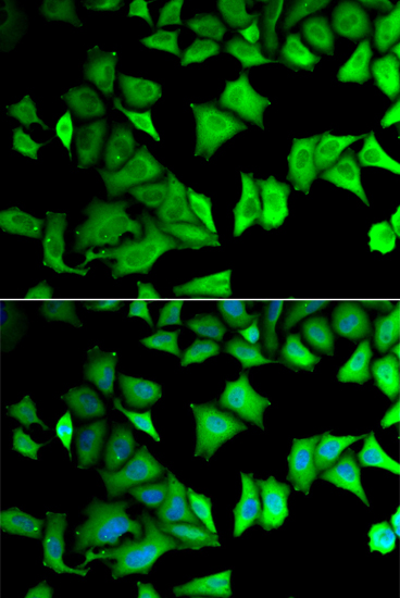 RPS12 Rabbit polyclonal antibody