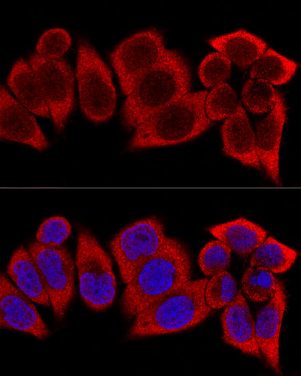 RPS12 Rabbit polyclonal antibody