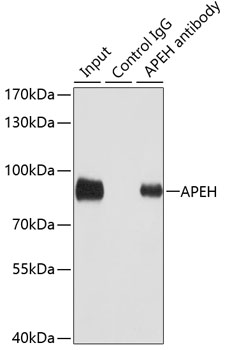 [KO Validated] APEH Rabbit polyclonal antibody