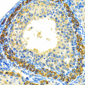 MRPL28 Rabbit polyclonal antibody