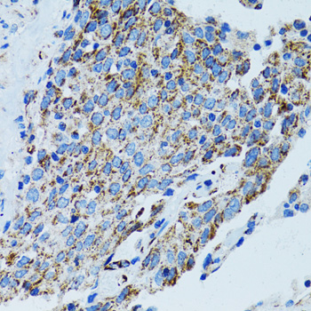 MRPL28 Rabbit polyclonal antibody