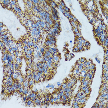 MRPL28 Rabbit polyclonal antibody