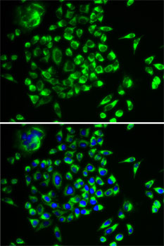 MRPL28 Rabbit polyclonal antibody