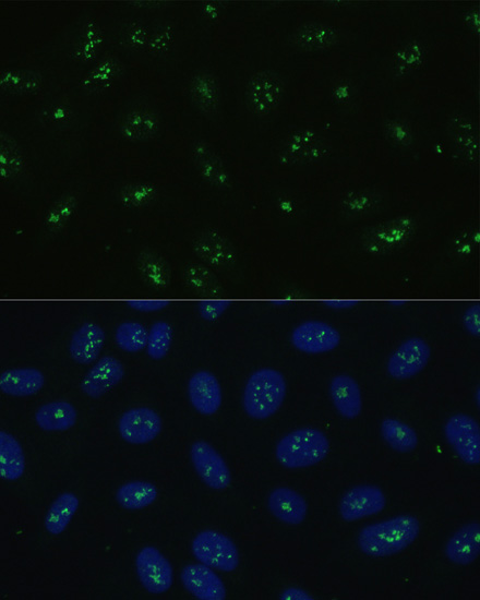 NOLC1 Rabbit polyclonal antibody