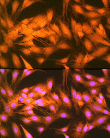 FGF1 Rabbit monoclonal antibody