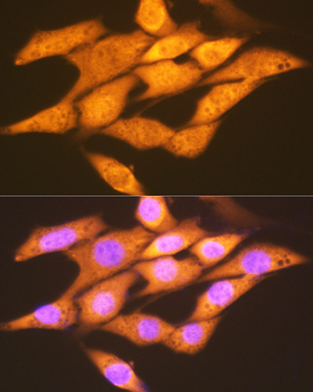 FGF1 Rabbit monoclonal antibody
