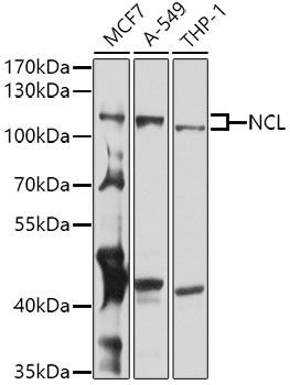 NCL Rabbit polyclonal antibody