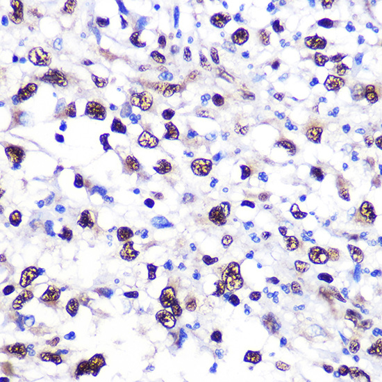 NCL Rabbit polyclonal antibody