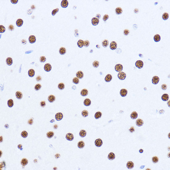 Matrin 3 Rabbit polyclonal antibody