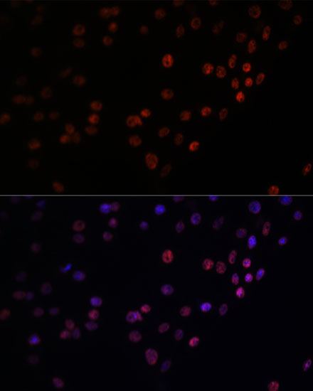 Matrin 3 Rabbit polyclonal antibody