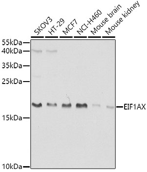 EIF1AX Rabbit polyclonal antibody