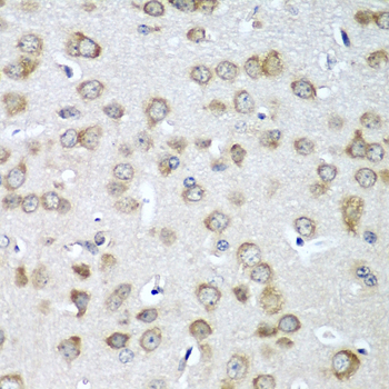 EIF1AX Rabbit polyclonal antibody