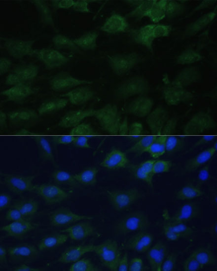 EIF1AX Rabbit polyclonal antibody