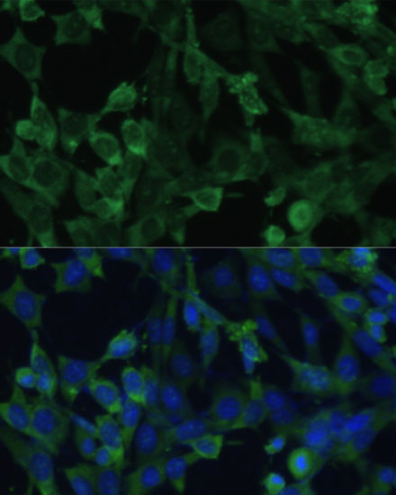 EIF1AX Rabbit polyclonal antibody