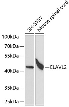 ELAVL2 Rabbit polyclonal antibody