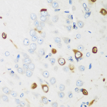 ELAVL2 Rabbit polyclonal antibody