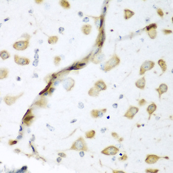 ELAVL2 Rabbit polyclonal antibody