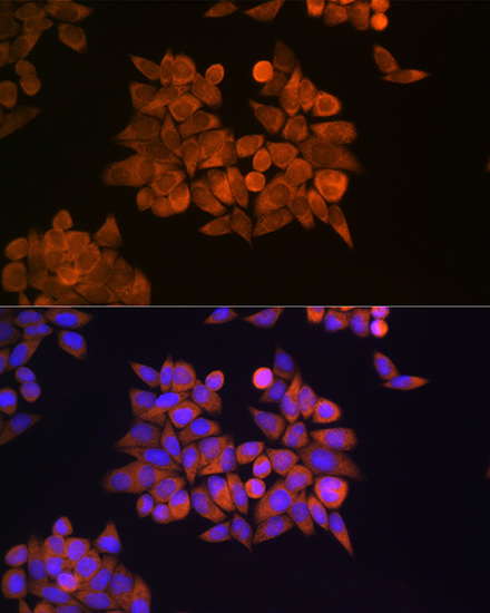 ETF1 Rabbit polyclonal antibody