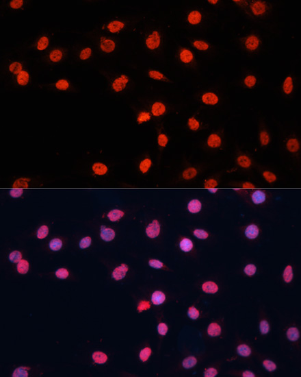 [KO Validated] FUS Rabbit polyclonal antibody