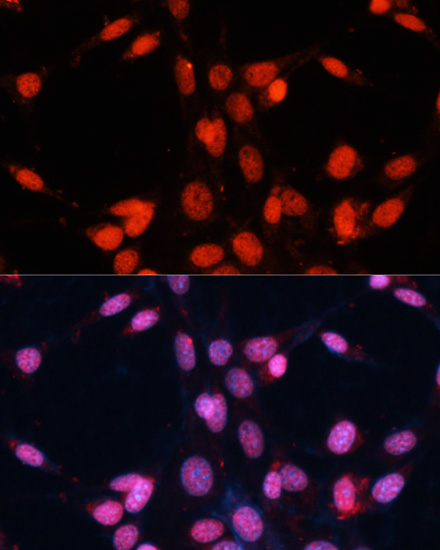 [KO Validated] FUS Rabbit polyclonal antibody