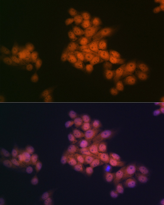 WAPL Rabbit monoclonal antibody