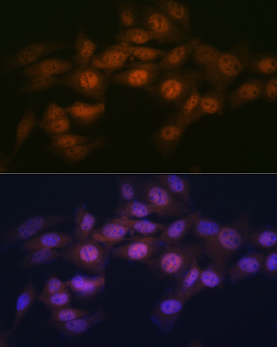 WAPL Rabbit monoclonal antibody