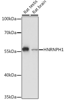 HNRNPH1 Rabbit polyclonal antibody