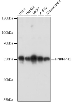 HNRNPH1 Rabbit polyclonal antibody