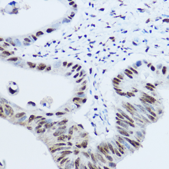 HNRNPH1 Rabbit polyclonal antibody