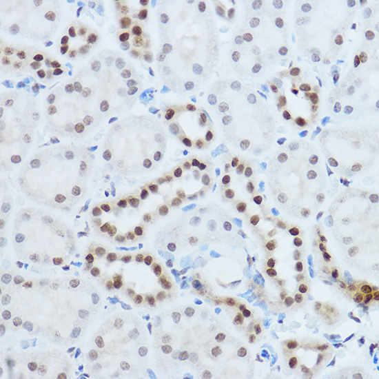 HNRNPH1 Rabbit polyclonal antibody