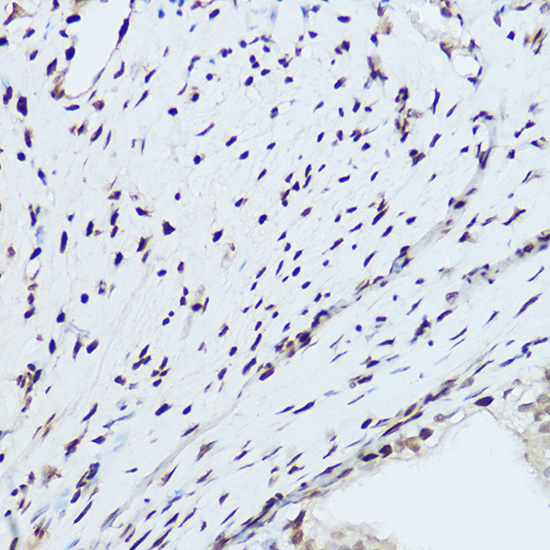HNRNPH1 Rabbit polyclonal antibody