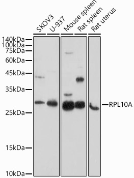 RPL10A Rabbit polyclonal antibody