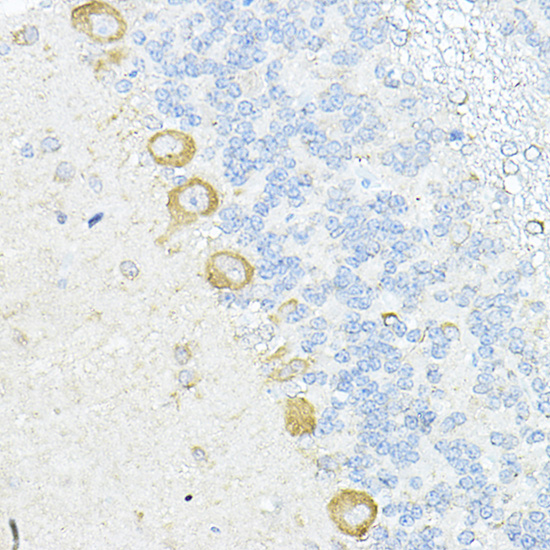 RPL10A Rabbit polyclonal antibody