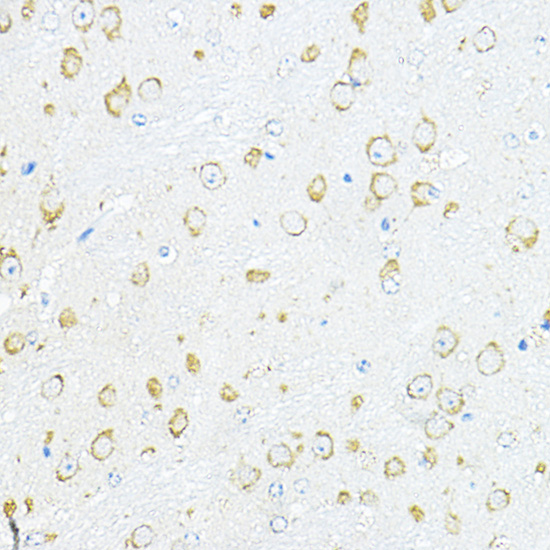 RPL10A Rabbit polyclonal antibody