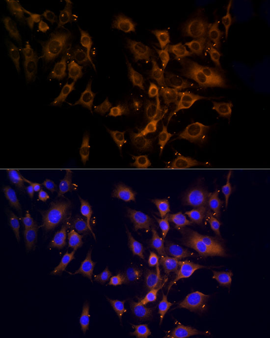 RPL10A Rabbit polyclonal antibody