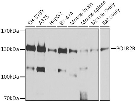 POLR2B Rabbit polyclonal antibody