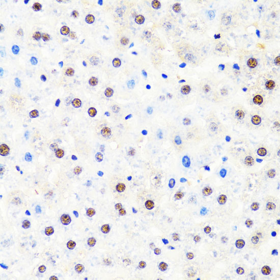 POLR2B Rabbit polyclonal antibody
