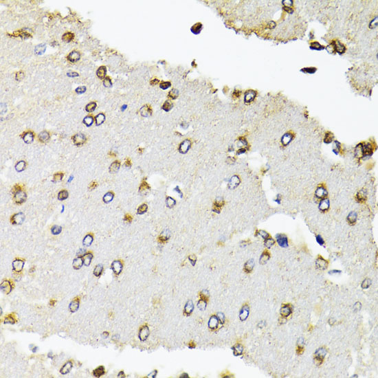 POLR2B Rabbit polyclonal antibody