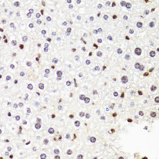 POLR2B Rabbit polyclonal antibody