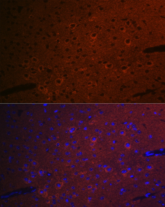 CEND1 Rabbit monoclonal antibody